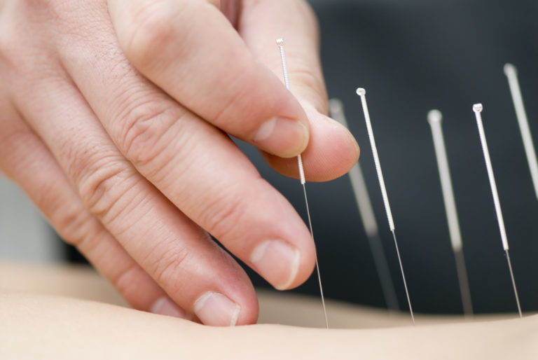 What does acupuncture do? Blue Mountains Acupuncture